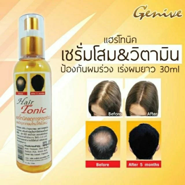 Genive Hair Tonic Stop Hair Loss 120ml – Scalp Treatment & Hair Growth Support