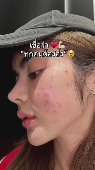 GM Great Match Glassy Alpine Rose Cream – Alpine Stem Cell | Plump, Bright & Anti-Aging
