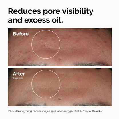 The Ordinary Niacinamide 10% Zinc 1% Serum bottle packaging Thailand water-based balancing facial serum for blemish prone skin