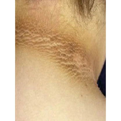 THIPS SKIN CLEANSING SOAP 120 G