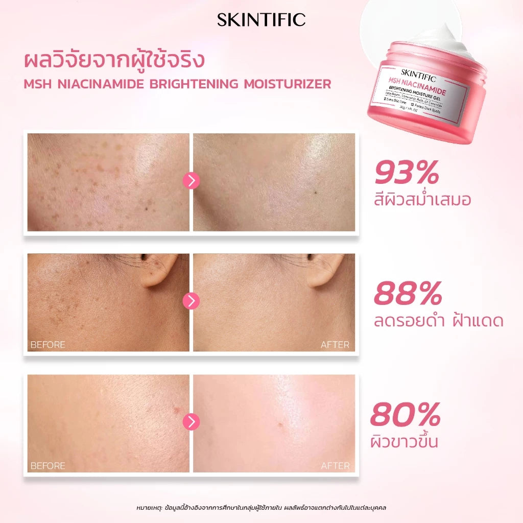 Skintific MSH Niacinamide Brightening Moisture Gel 30g tube packaging Thailand brightening gel skincare
