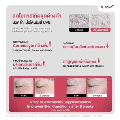 Woman taking Dr. PONG astaxanthin capsules for radiant spot-free skin before after