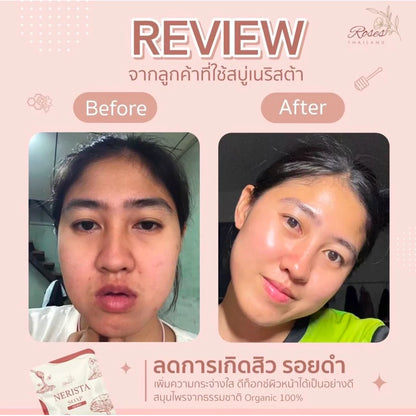 Asian woman using Nerista acne soap demonstrating gentle circular massage technique for clear bright skin results