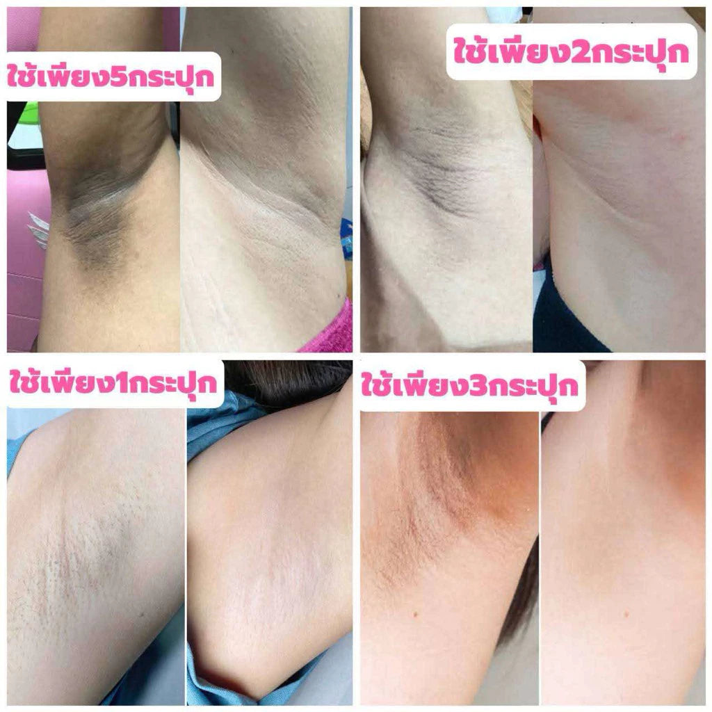 Woman applying Janena Sweety Cream for smooth bright radiant delicate skin before after results
